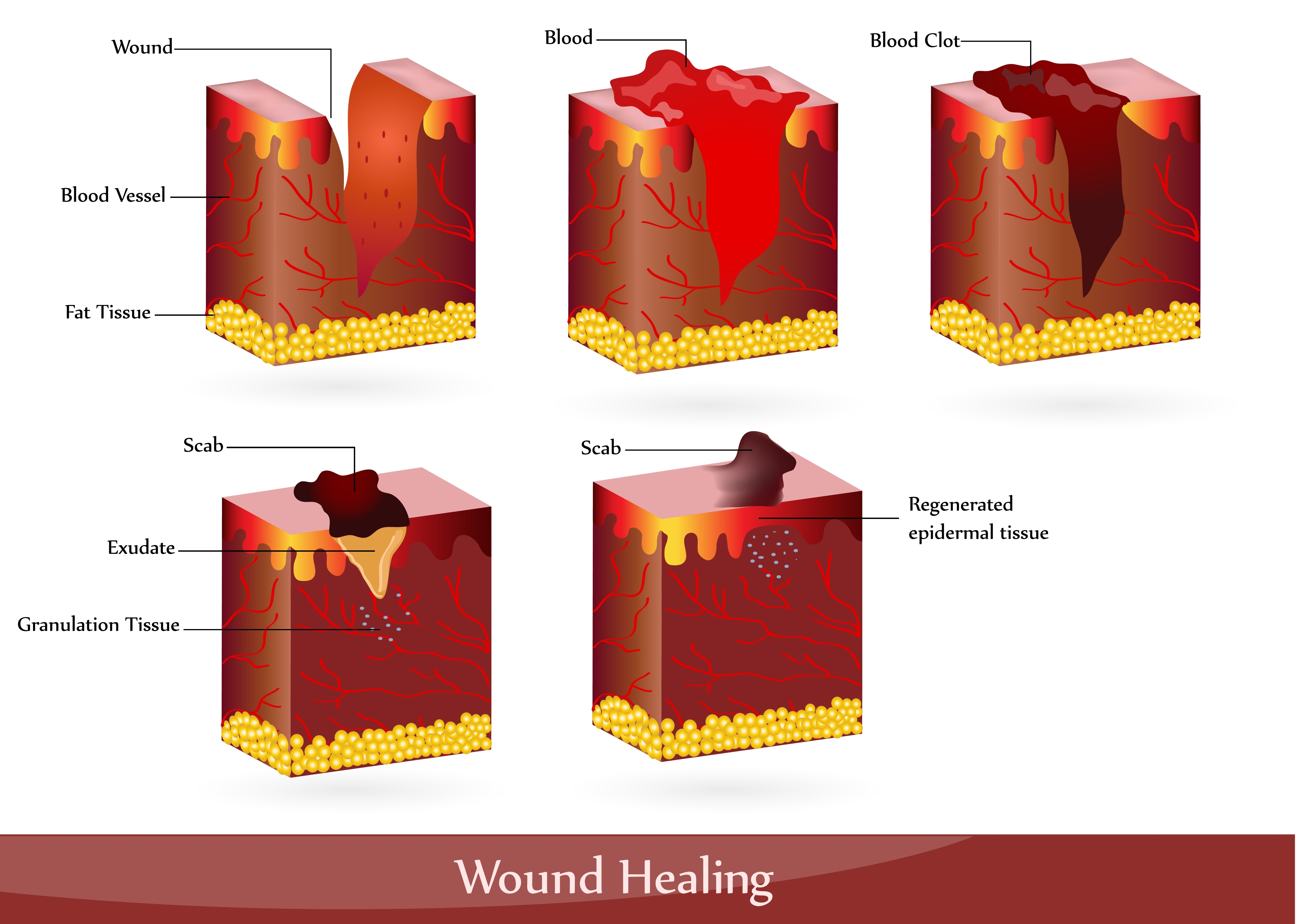 healing process - First Aid Wiki